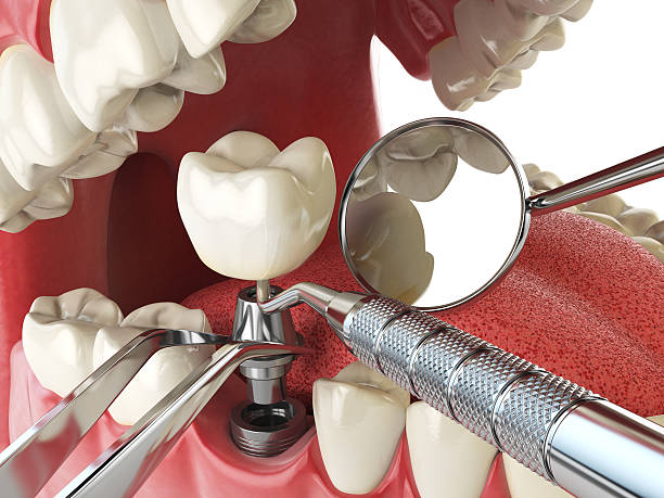 Best Broken or Cracked Tooth Emergency Dentist in Wabasso, FL